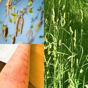 Read more about the article What Is Allergy Testing For Hay Fever Really Like?