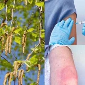 Read more about the article Do Allergy Shots Work? How Immunotherapy Improved My Hay Fever (Interview)